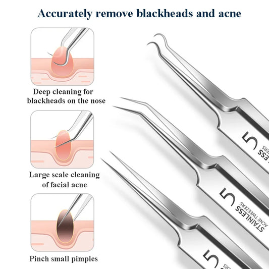 Velixia Skin Care Tool Kit