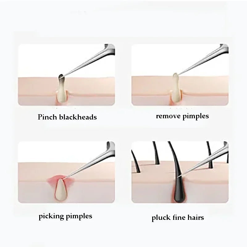 Velixia Skin Care Tool Kit